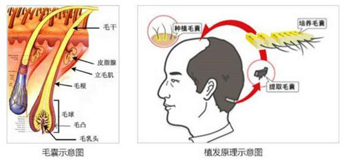 毛囊提取