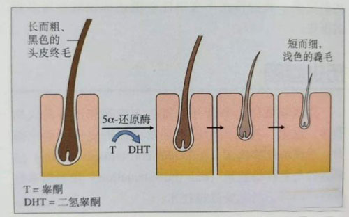 NAT生态美学植发